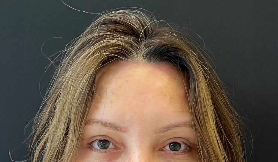 Antes